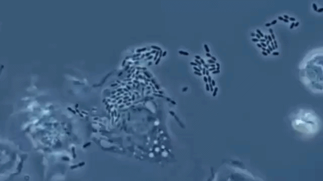 PhagocytosisWhiteBloodCellsEngagedInWork.gif